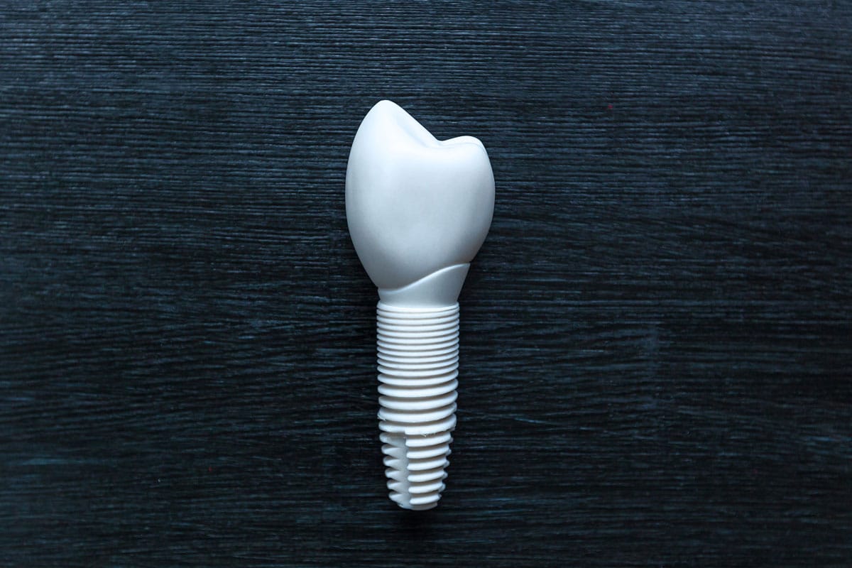 Zirconia dental implants blog post
